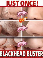 🌿 Green Mask Stick -  Meilleur purifiant qui nettoie les pores et lisse la peau.