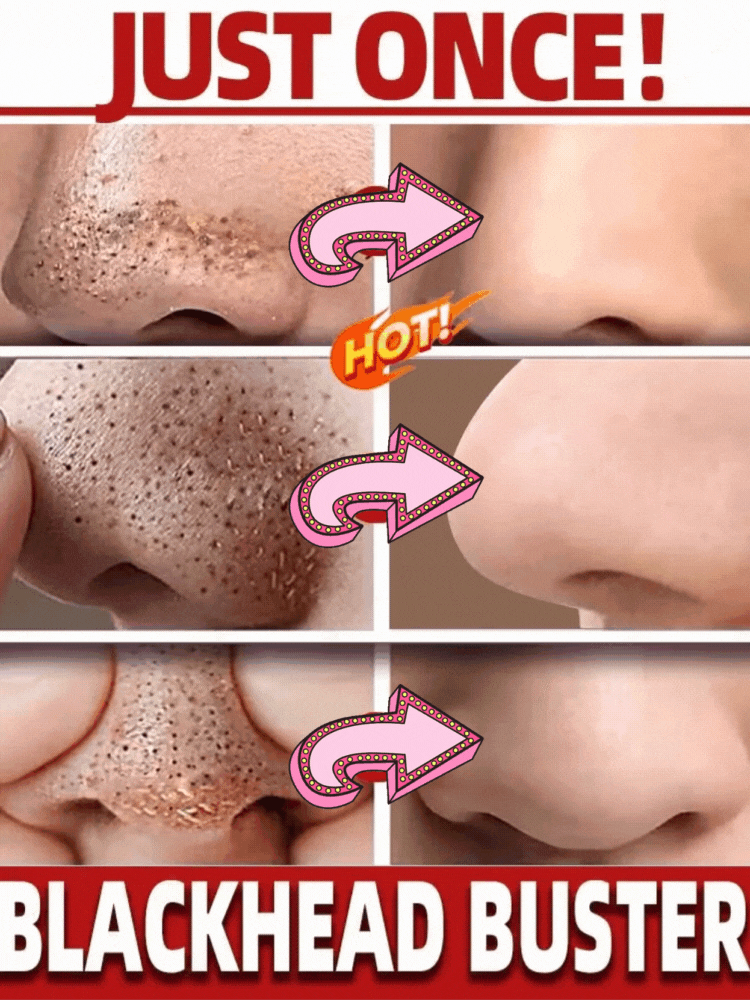 🌿 Green Mask Stick -  Meilleur purifiant qui nettoie les pores et lisse la peau.