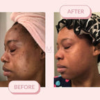 🌿 Green Mask Stick -  Meilleur purifiant qui nettoie les pores et lisse la peau.