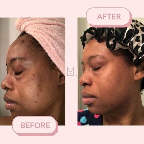 🌿 Green Mask Stick -  Meilleur purifiant qui nettoie les pores et lisse la peau.