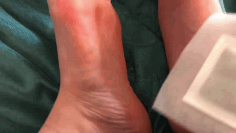 PATCH DÉTOX PIEDS Kinoki – 🔥 2 ACHETÉS = 1 OFFERT