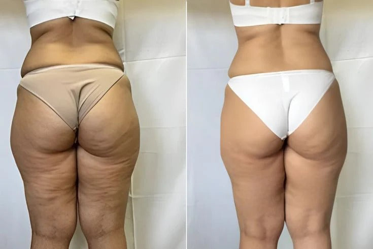 PATCH DÉTOX PIEDS Kinoki – 🔥 2 ACHETÉS = 1 OFFERT