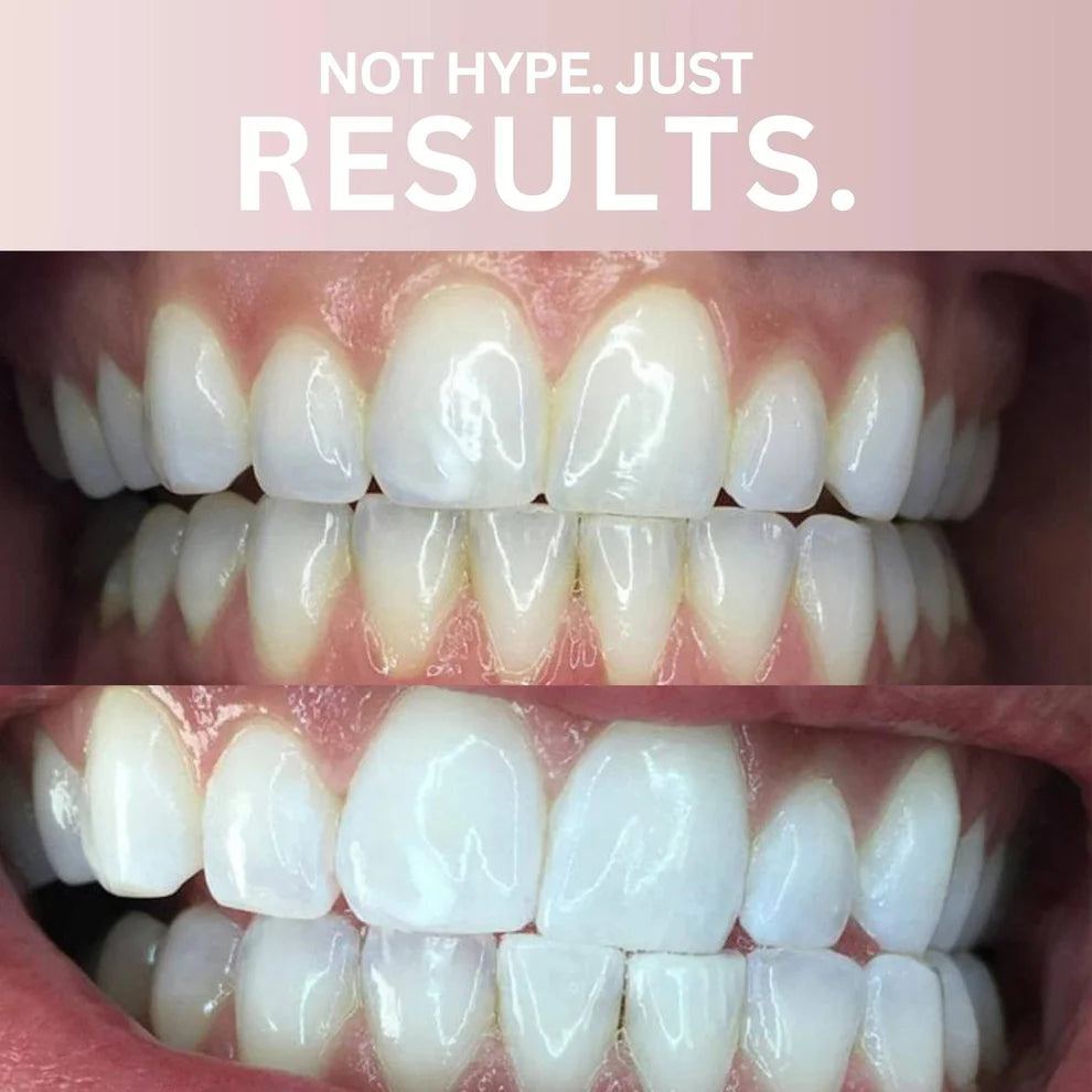 Meilleures Bandes De Blanchiment